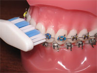 Dental Emergencies