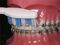 Dental Emergencies