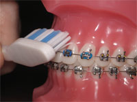 Dental Emergencies